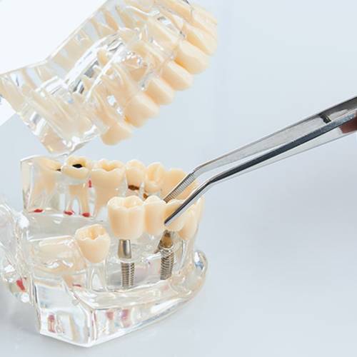 general dentistry orthodontics stonehaven dental orthodontics waco tx services dentures bridges
