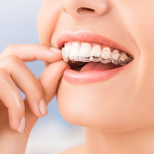 general dentistry orthodontics stonehaven dental orthodontics waco tx services invisalign and invisalign teen