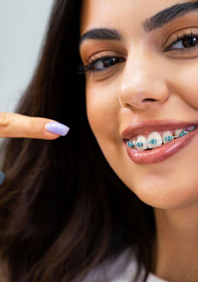 Happy woman showing new braces after orthodontic visit in Burleson