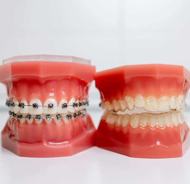 Straighten Your Smile With Our Burleson Orthodontist’s Help